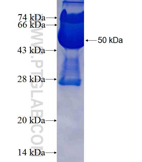 NUDT5 fusion protein Ag25485 SDS-PAGE