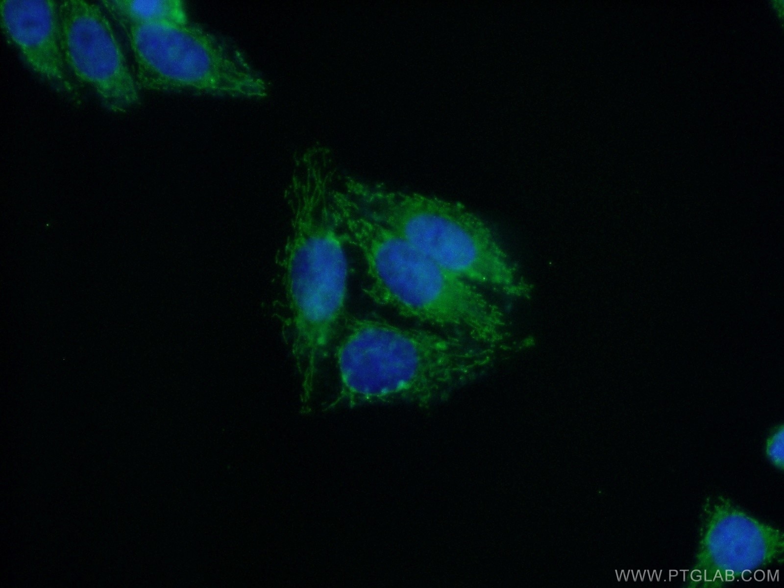 IF Staining of HepG2 using 11181-1-AP