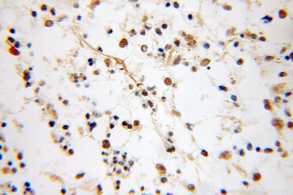 NUDT6 Polyclonal antibody