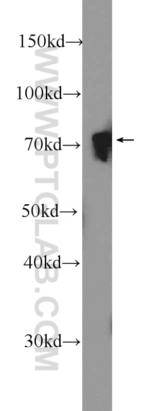 Western Blot (WB) analysis of rat liver tissue using NUDT6 Polyclonal antibody (11181-1-AP)