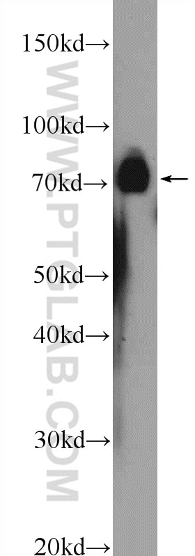 Western Blot (WB) analysis of rat heart tissue using NUDT6 Polyclonal antibody (11181-1-AP)