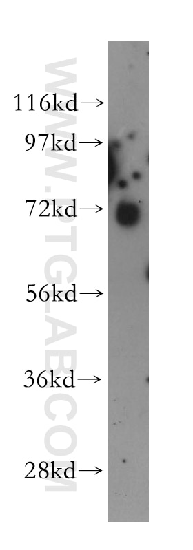 Western Blot (WB) analysis of human heart tissue using NUDT6 Polyclonal antibody (11181-1-AP)