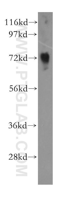 Western Blot (WB) analysis of Jurkat cells using NUDT6 Polyclonal antibody (11181-1-AP)
