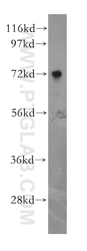 Western Blot (WB) analysis of HepG2 cells using NUDT6 Polyclonal antibody (11181-1-AP)