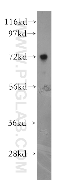 Western Blot (WB) analysis of HepG2 cells using NUDT6 Polyclonal antibody (11181-1-AP)