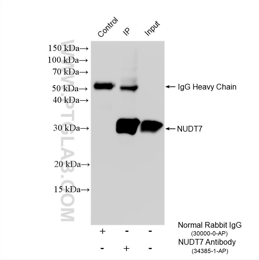 Immunoprecipitation (IP) experiment of mouse liver tissue using NUDT7 Polyclonal antibody (34385-1-AP)