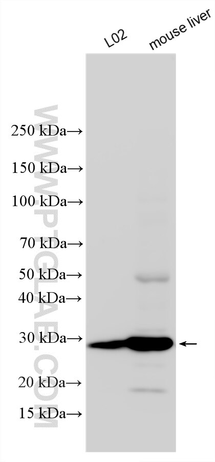 Western Blot (WB) analysis of various lysates using NUDT7 Polyclonal antibody (34385-1-AP)