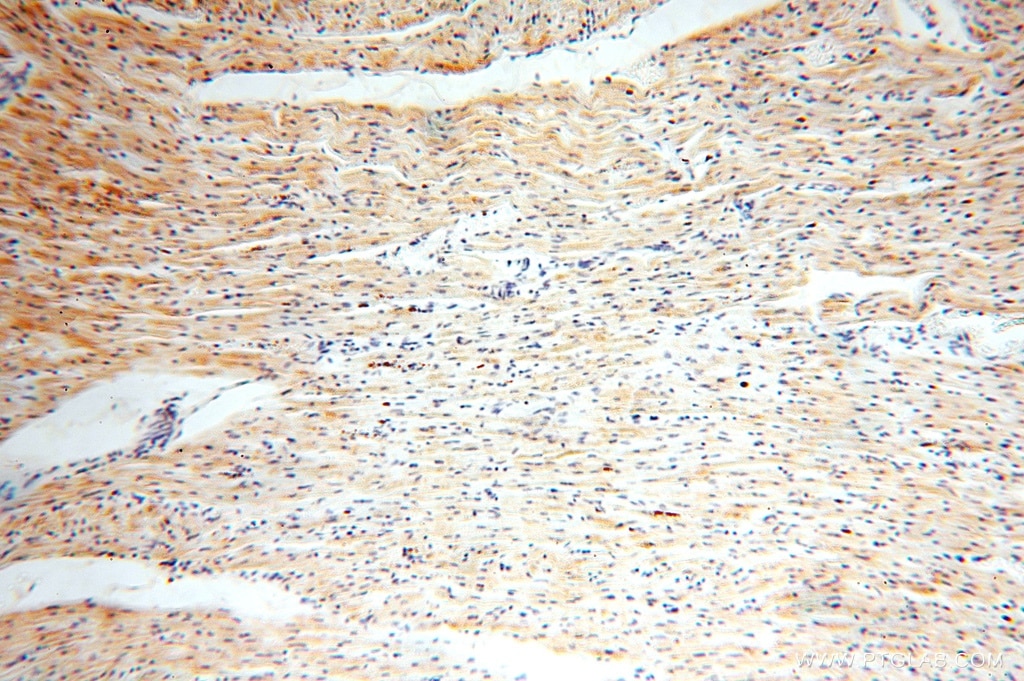 Immunohistochemistry (IHC) staining of human heart tissue using NUDT8 Polyclonal antibody (16098-1-AP)