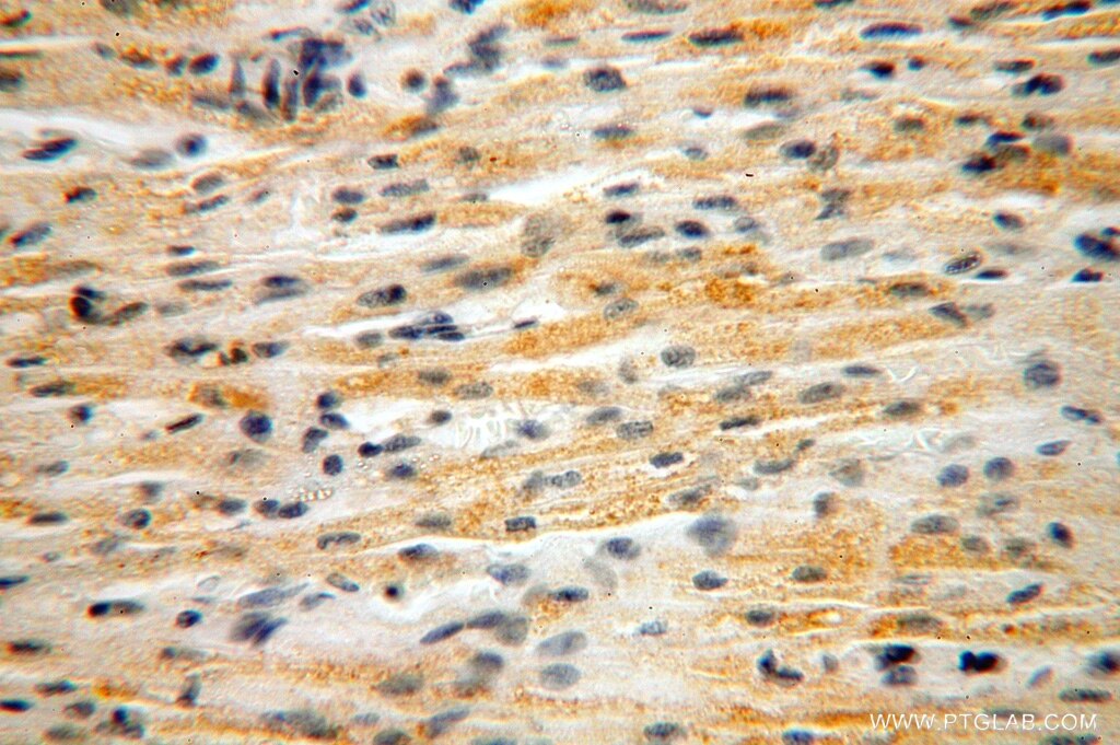 Immunohistochemistry (IHC) staining of human heart tissue using NUDT8 Polyclonal antibody (16098-1-AP)