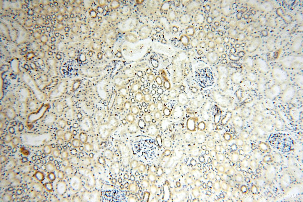 Immunohistochemistry (IHC) staining of human kidney tissue using NUDT8 Polyclonal antibody (16098-1-AP)