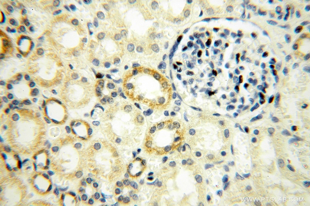 Immunohistochemistry (IHC) staining of human kidney tissue using NUDT8 Polyclonal antibody (16098-1-AP)