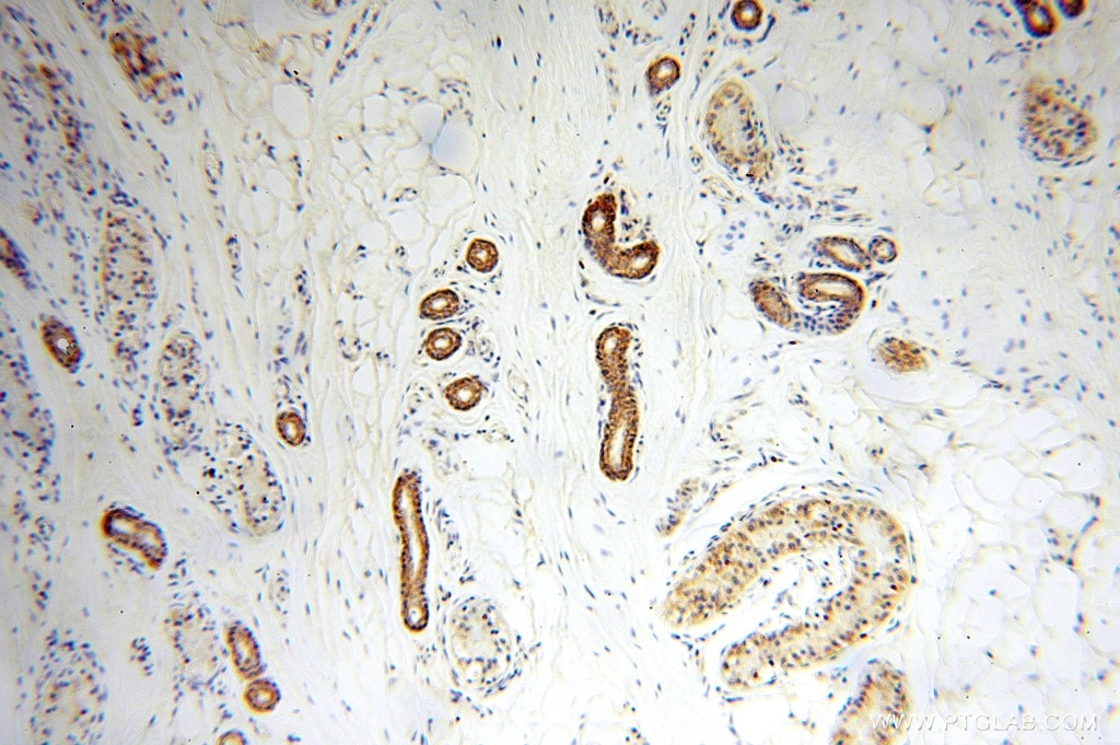 Immunohistochemistry (IHC) staining of human skin tissue using NUDT8 Polyclonal antibody (16098-1-AP)