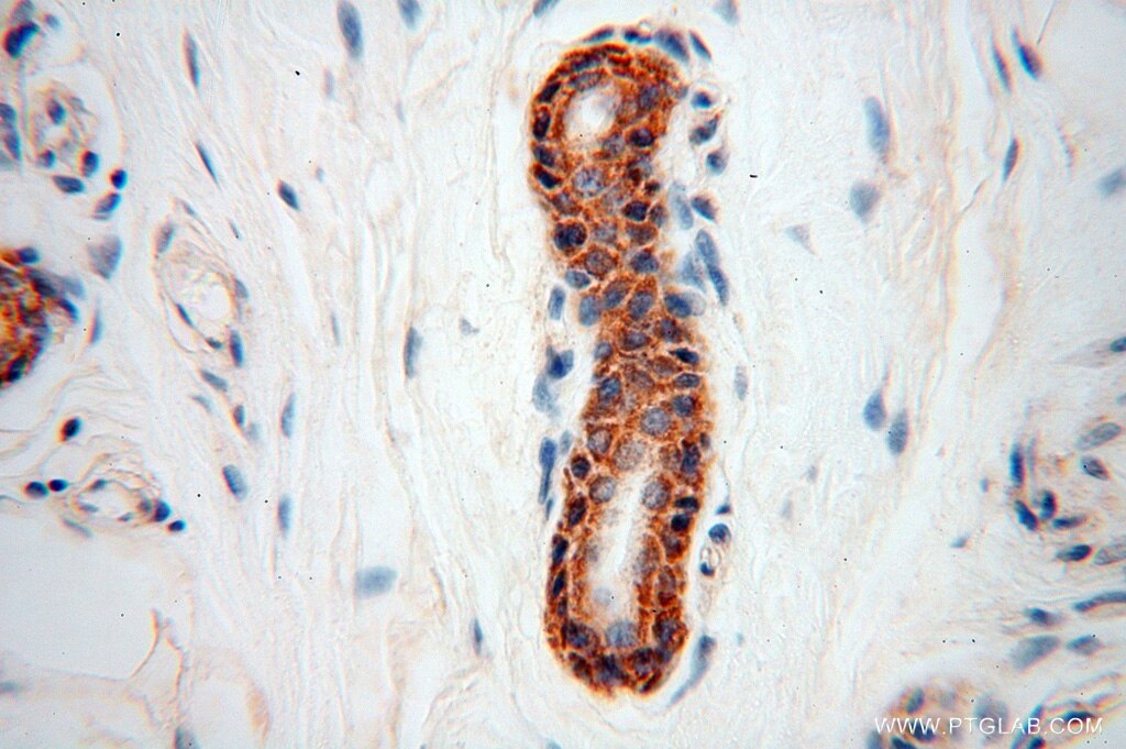 Immunohistochemistry (IHC) staining of human skin tissue using NUDT8 Polyclonal antibody (16098-1-AP)