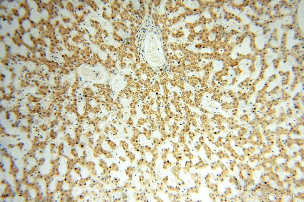 Immunohistochemistry (IHC) staining of human liver tissue using NUDT8 Polyclonal antibody (16098-1-AP)