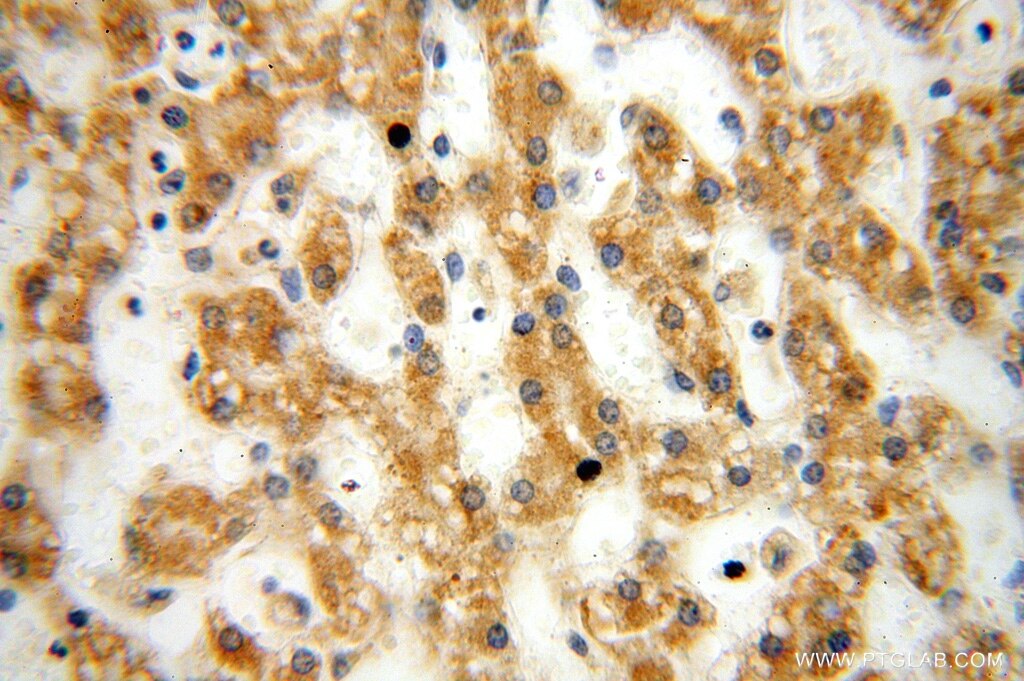 Immunohistochemistry (IHC) staining of human liver tissue using NUDT8 Polyclonal antibody (16098-1-AP)