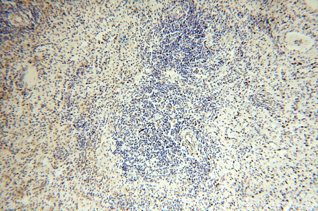 Immunohistochemistry (IHC) staining of human spleen tissue using NUDT8 Polyclonal antibody (16098-1-AP)