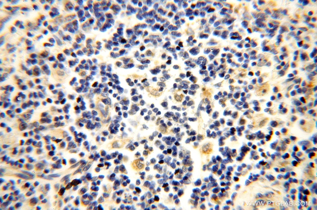 Immunohistochemistry (IHC) staining of human spleen tissue using NUDT8 Polyclonal antibody (16098-1-AP)
