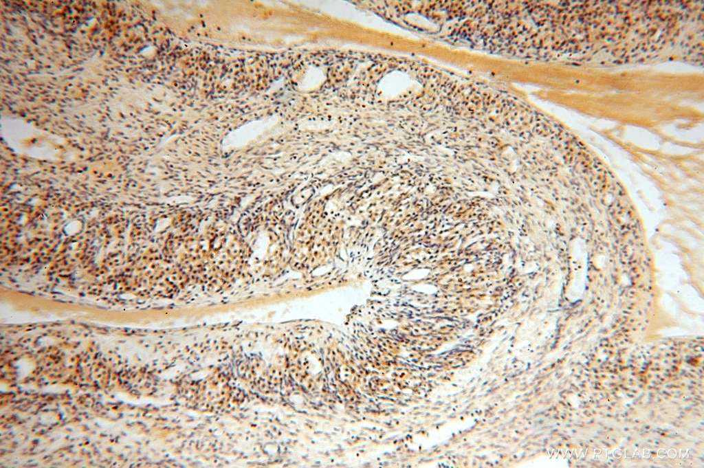 Immunohistochemistry (IHC) staining of human ovary tissue using NUDT8 Polyclonal antibody (16098-1-AP)