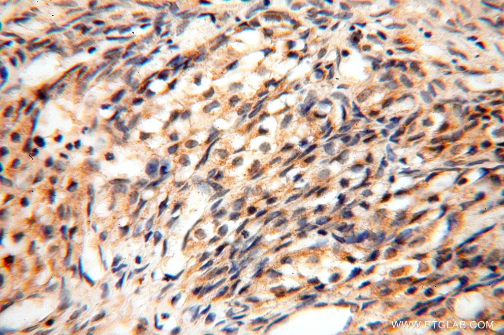 Immunohistochemistry (IHC) staining of human ovary tissue using NUDT8 Polyclonal antibody (16098-1-AP)