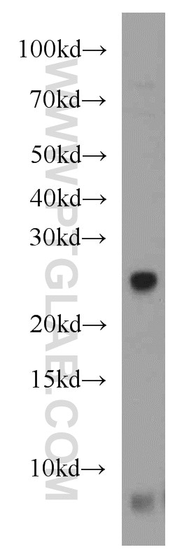 Western Blot (WB) analysis of Jurkat cells using NUDT8 Polyclonal antibody (16098-1-AP)