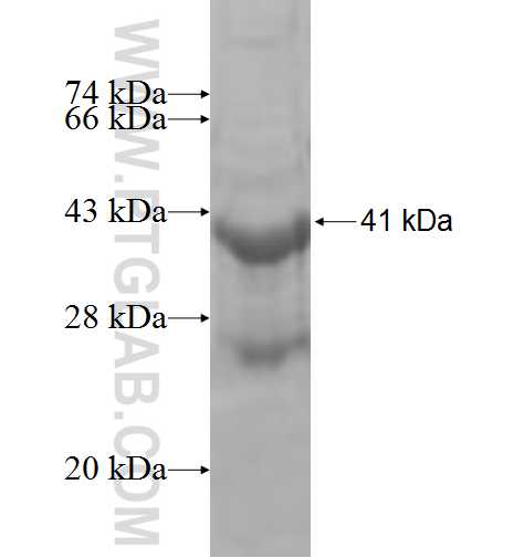 NUDT8 fusion protein Ag8945 SDS-PAGE