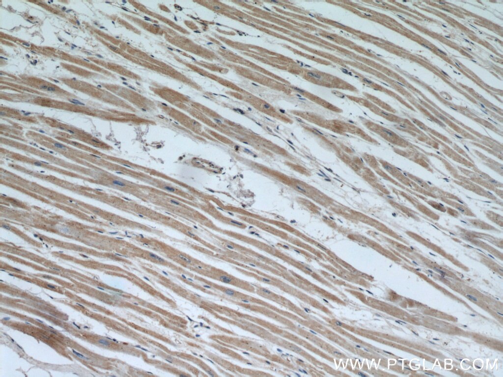 Immunohistochemistry (IHC) staining of human heart tissue using NUDT9 Polyclonal antibody (15068-1-AP)