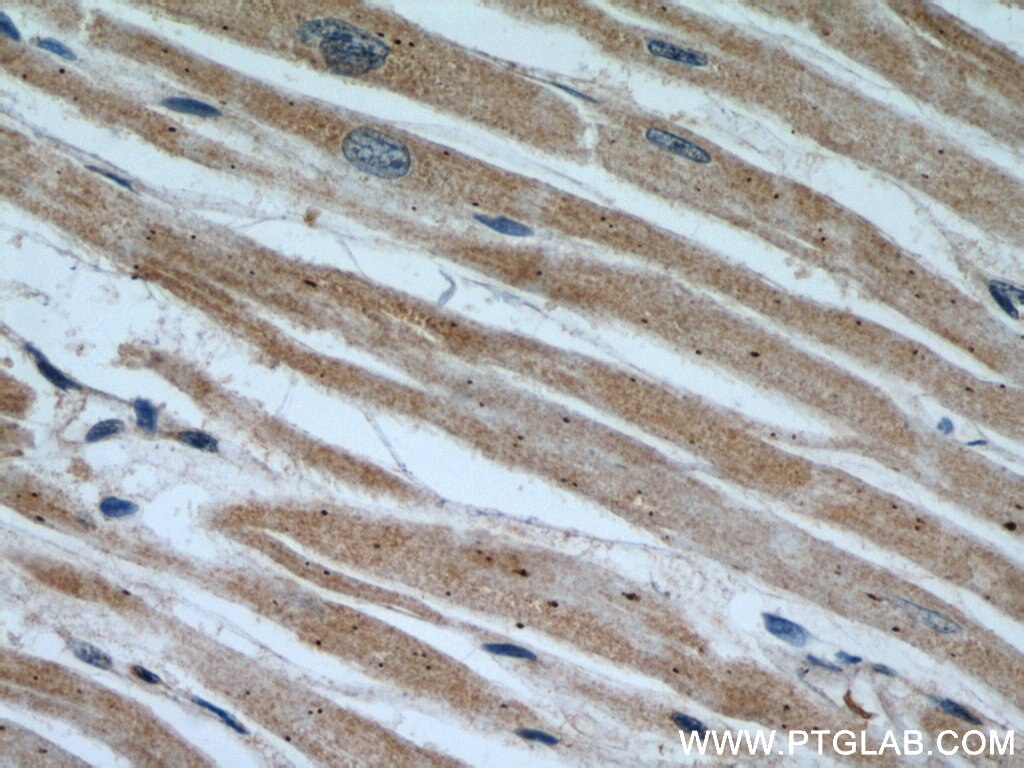 Immunohistochemistry (IHC) staining of human heart tissue using NUDT9 Polyclonal antibody (15068-1-AP)