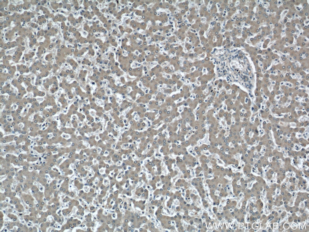 IHC staining of human liver using 15068-1-AP