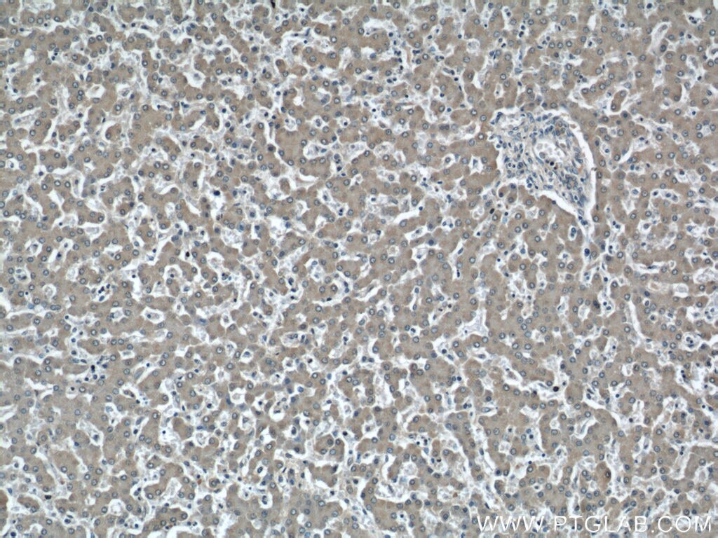 Immunohistochemistry (IHC) staining of human liver tissue using NUDT9 Polyclonal antibody (15068-1-AP)