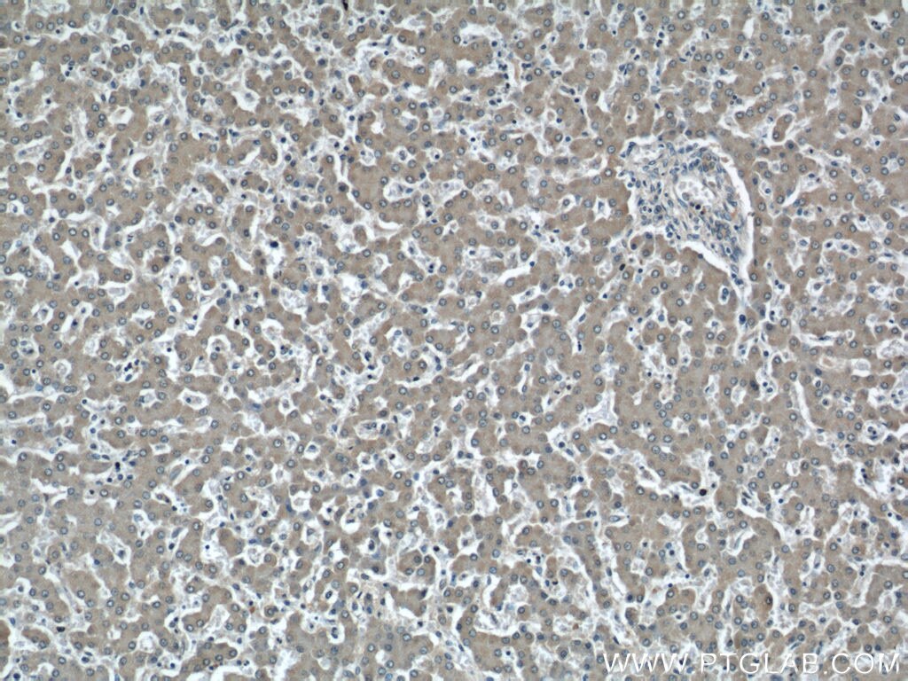 Immunohistochemistry (IHC) staining of human liver tissue using NUDT9 Polyclonal antibody (15068-1-AP)