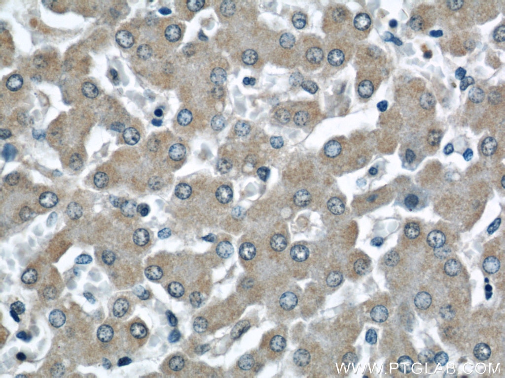 Immunohistochemistry (IHC) staining of human liver tissue using NUDT9 Polyclonal antibody (15068-1-AP)