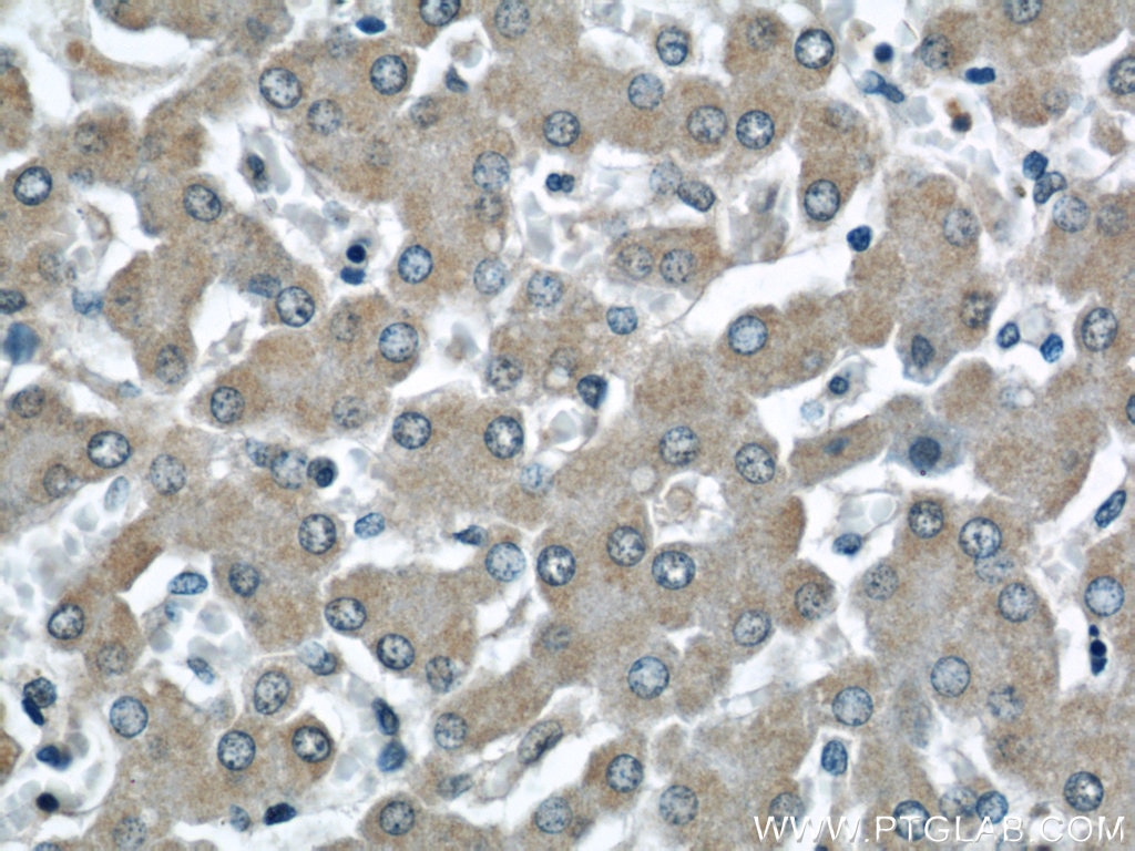 IHC staining of human liver using 15068-1-AP