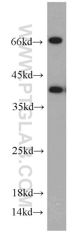 Western Blot (WB) analysis of Raji cells using NUDT9 Polyclonal antibody (15068-1-AP)