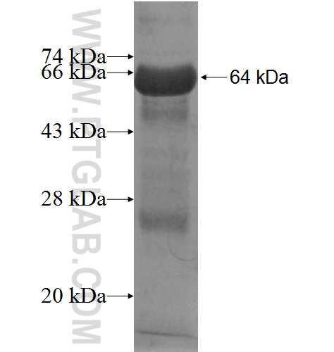 NUDT9 fusion protein Ag7075 SDS-PAGE