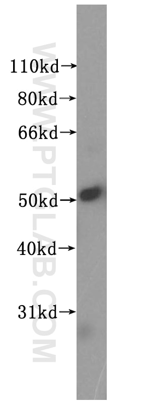 Western Blot (WB) analysis of HeLa cells using NUF2 Polyclonal antibody (15731-1-AP)