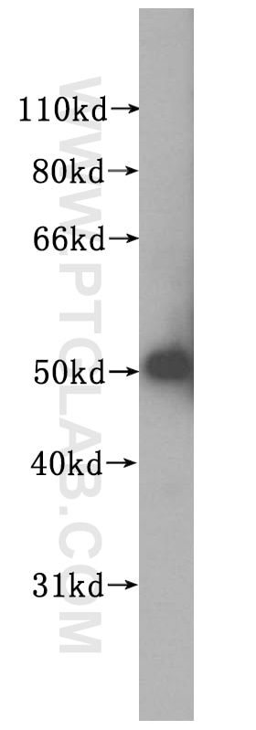 Western Blot (WB) analysis of human liver tissue using NUF2 Polyclonal antibody (15731-1-AP)