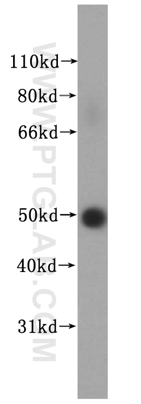 Western Blot (WB) analysis of human testis tissue using NUF2 Polyclonal antibody (15731-1-AP)