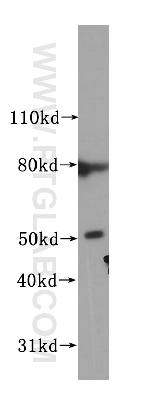Western Blot (WB) analysis of PC-3 cells using NUF2 Polyclonal antibody (15731-1-AP)