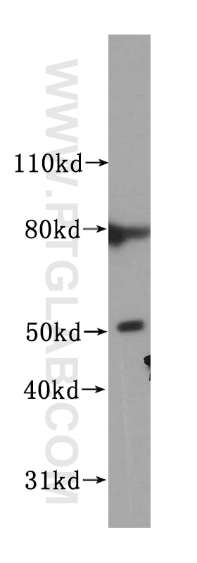 WB analysis of PC-3 using 15731-1-AP