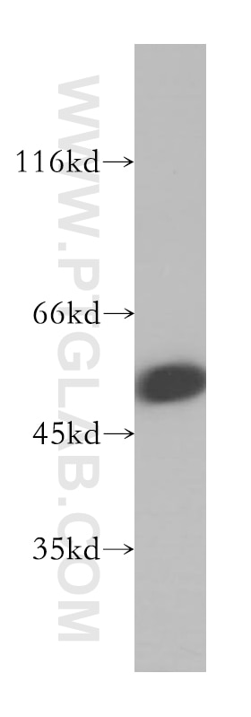 Western Blot (WB) analysis of human skeletal muscle tissue using NUF2 Polyclonal antibody (15731-1-AP)