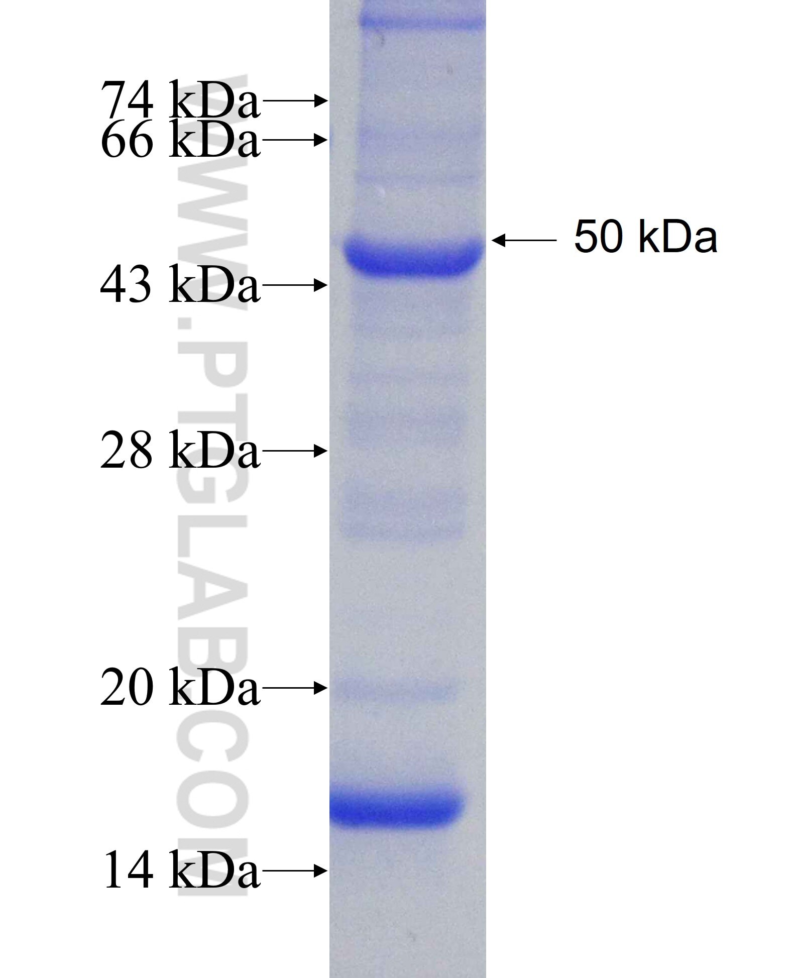 NUF2 fusion protein Ag8625 SDS-PAGE