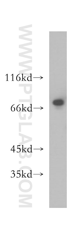 Western Blot (WB) analysis of A375 cells using NUFIP1 Polyclonal antibody (12515-1-AP)
