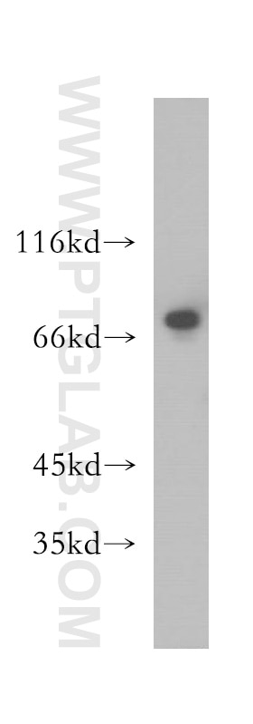 WB analysis of A375 using 12515-1-AP