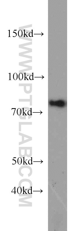 WB analysis of HeLa using 12515-1-AP