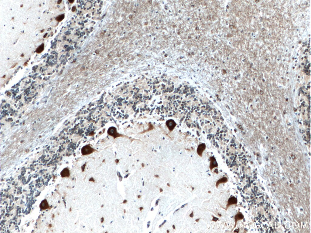 IHC staining of human cerebellum using 17752-1-AP