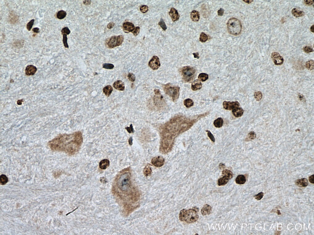 Immunohistochemistry (IHC) staining of mouse cerebellum tissue using NUFIP2 Monoclonal antibody (67195-1-Ig)