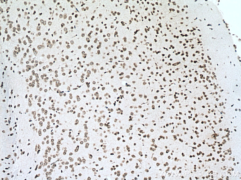 Immunohistochemistry (IHC) staining of mouse brain tissue using NUFIP2 Monoclonal antibody (67195-1-Ig)