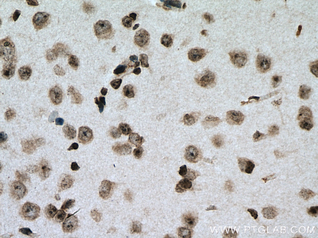 IHC staining of mouse brain using 67195-1-Ig