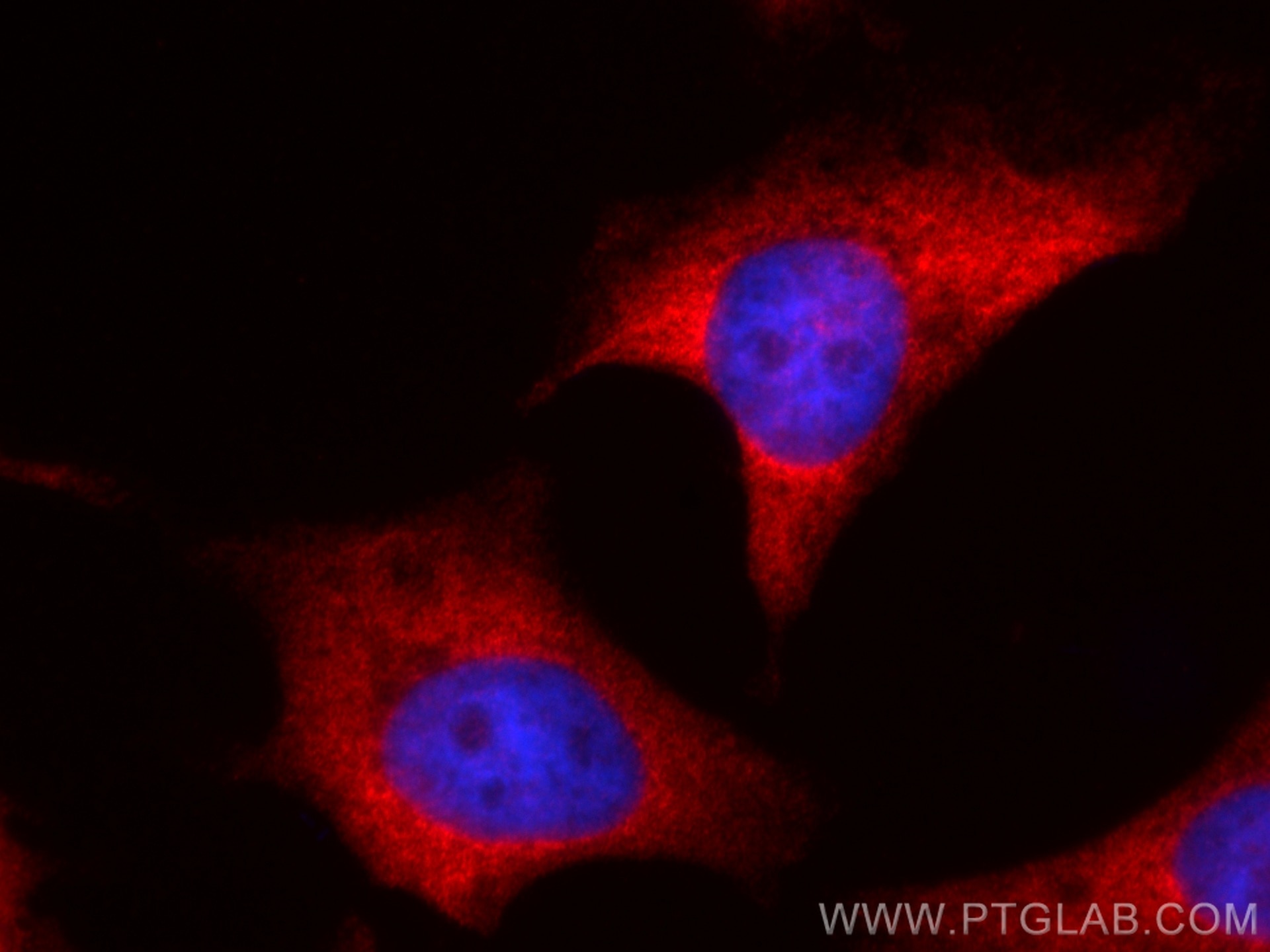 Immunofluorescence (IF) / fluorescent staining of HeLa cells using CoraLite®594-conjugated NUFIP2 Monoclonal antibody (CL594-67195)