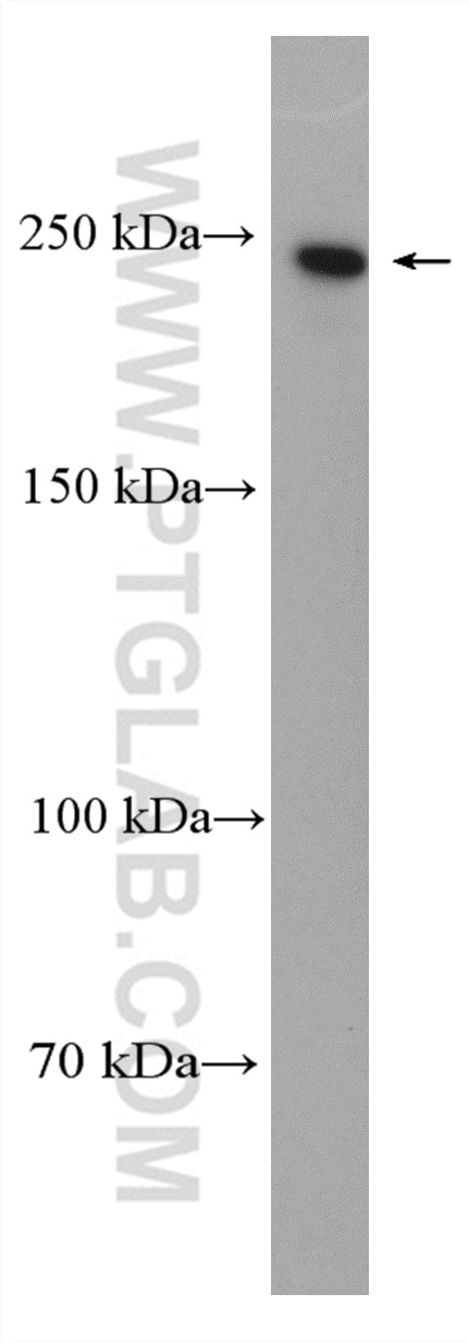 Western Blot (WB) analysis of HeLa cells using NuMA Polyclonal antibody (16607-1-AP)